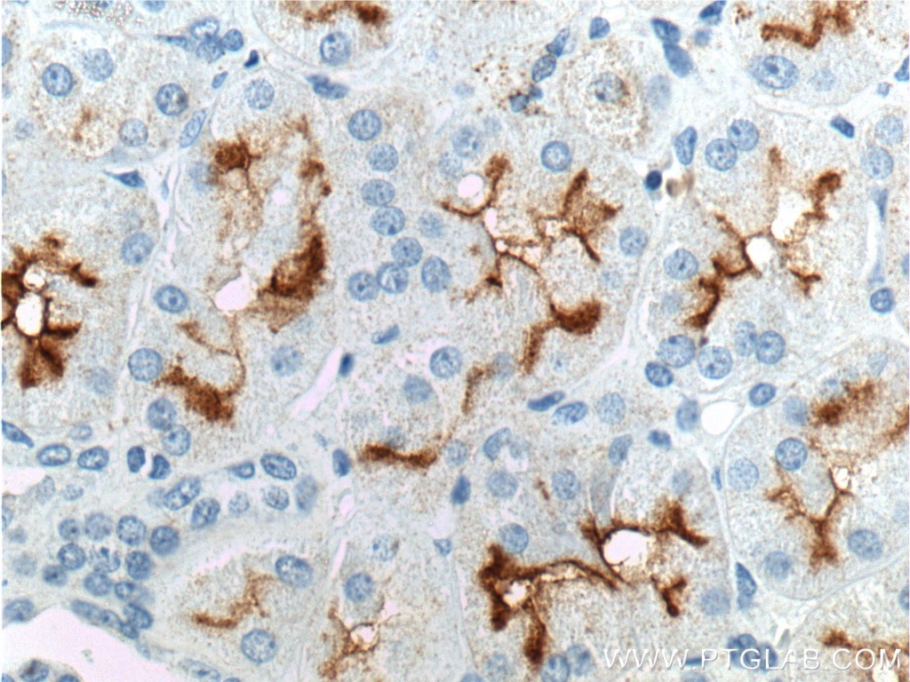 Immunohistochemistry (IHC) staining of human kidney tissue using XPNPEP2 Polyclonal antibody (25945-1-AP)