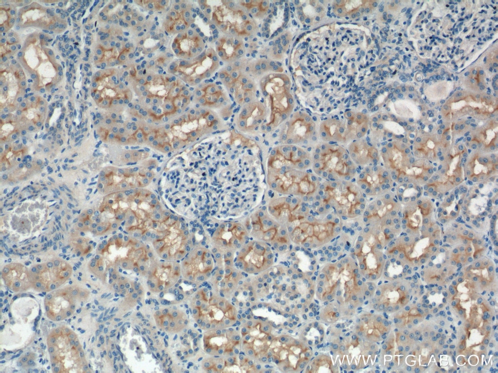 Immunohistochemistry (IHC) staining of human kidney tissue using XPNPEP2 Polyclonal antibody (25945-1-AP)