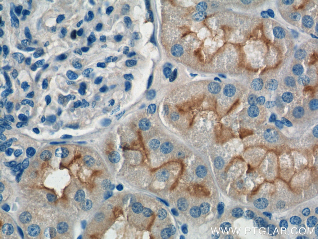 Immunohistochemistry (IHC) staining of human kidney tissue using XPNPEP2 Polyclonal antibody (25945-1-AP)