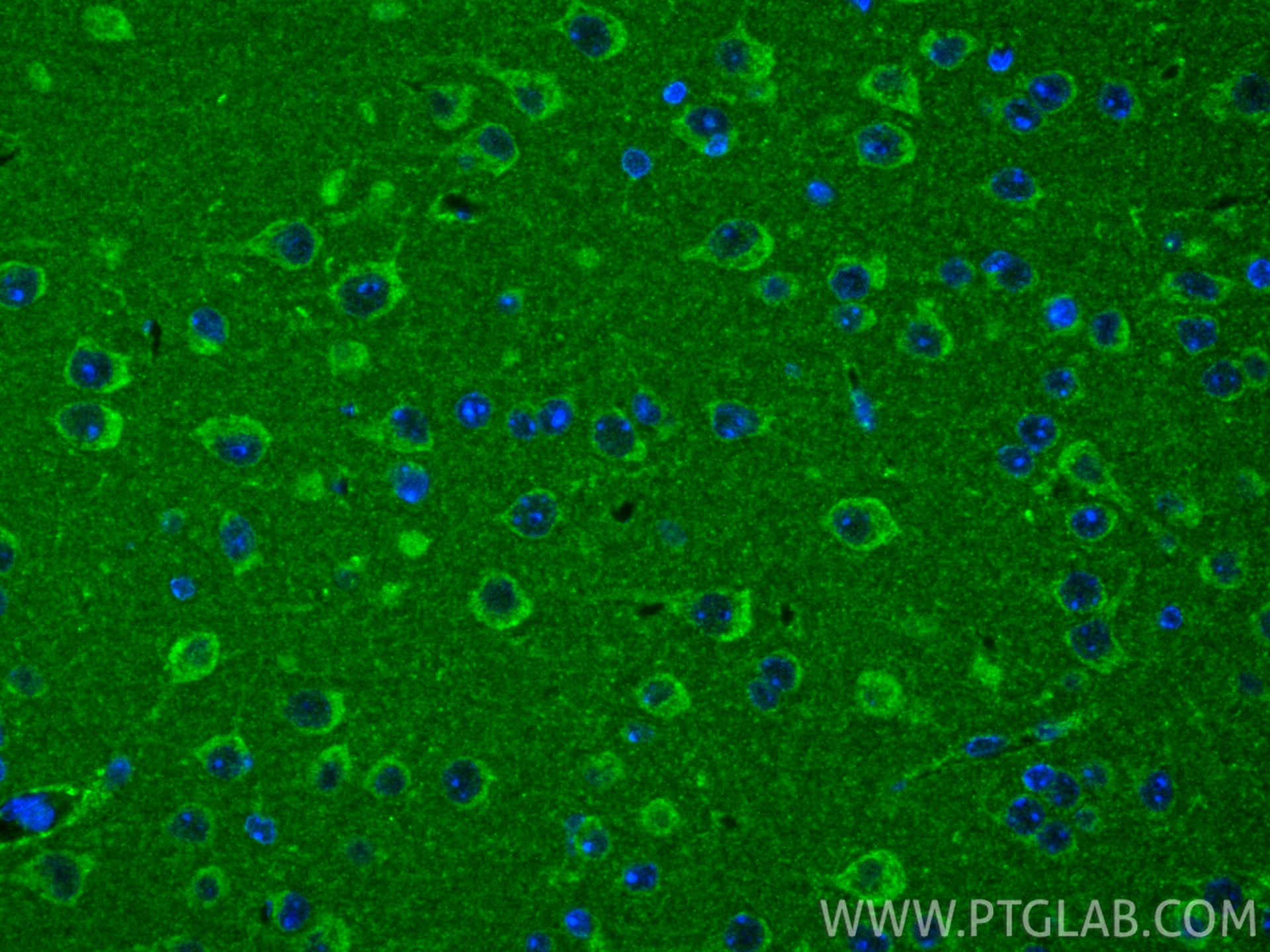 IF Staining of mouse brain using 15655-1-AP Immunofluorescence (IF) / fluorescent staining of mouse brain tissue using XPNPEP3 Polyclonal antibody (15655-1-AP)