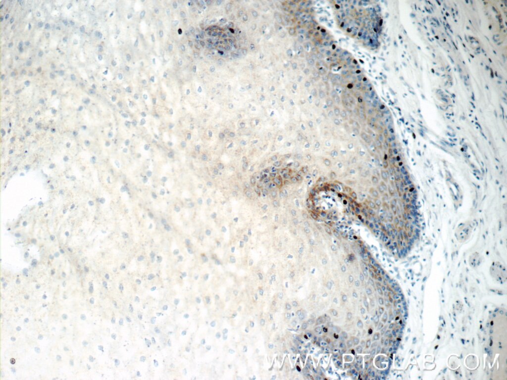 Immunohistochemistry (IHC) staining of human oesophagus tissue using XPNPEP3 Polyclonal antibody (15655-1-AP)