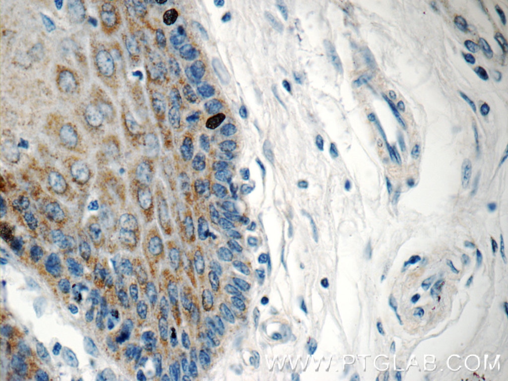 Immunohistochemistry (IHC) staining of human oesophagus tissue using XPNPEP3 Polyclonal antibody (15655-1-AP)
