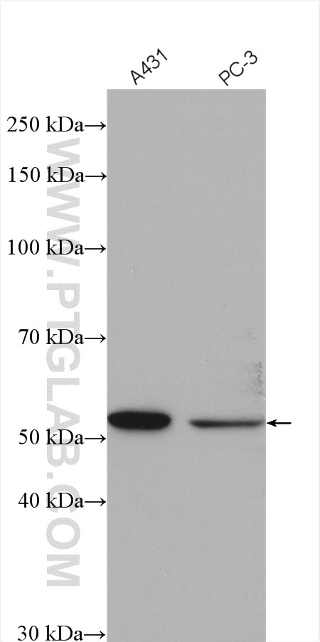 Western Blot (WB) analysis of various lysates using XPNPEP3 Polyclonal antibody (15655-1-AP)