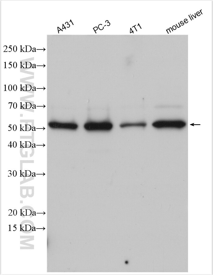 Western Blot (WB) analysis of various lysates using XPNPEP3 Polyclonal antibody (15655-1-AP)