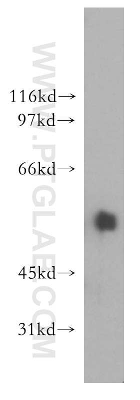 Western Blot (WB) analysis of human testis tissue using XPNPEP3 Polyclonal antibody (15655-1-AP)