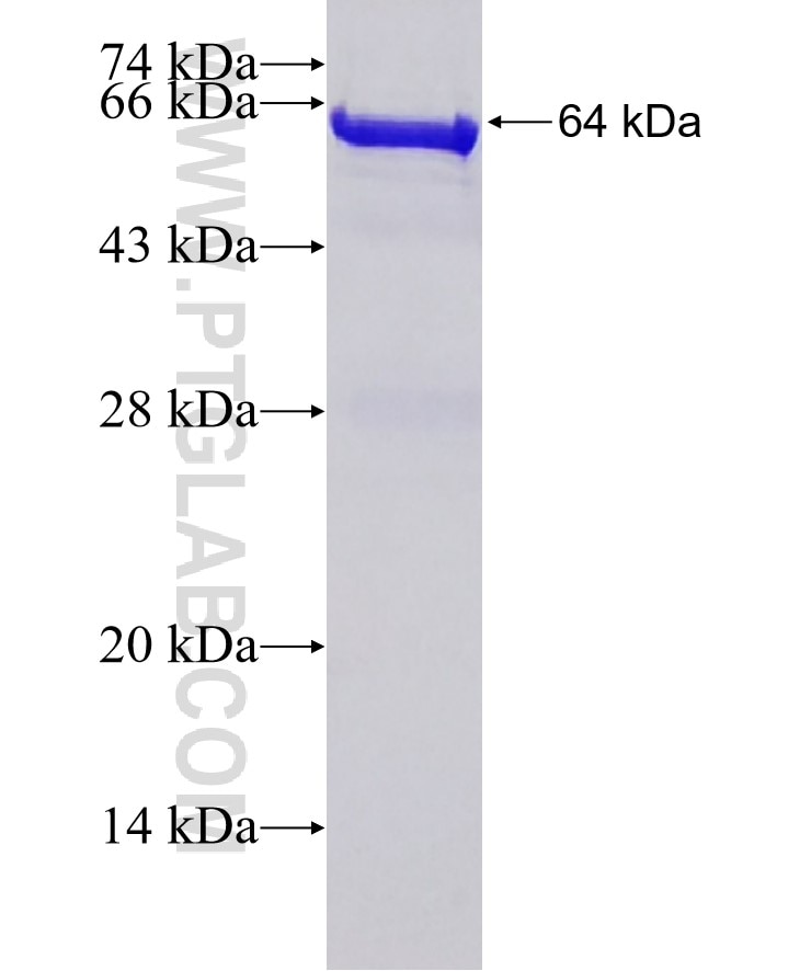 XPNPEP3 fusion protein Ag8007 SDS-PAGE