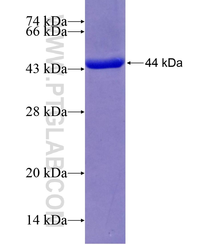 XPNPEP3 fusion protein Ag8030 SDS-PAGE