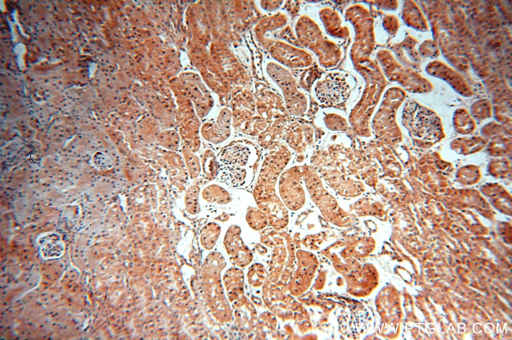 Immunohistochemistry (IHC) staining of human kidney tissue using CRM1 Polyclonal antibody (12915-1-AP)