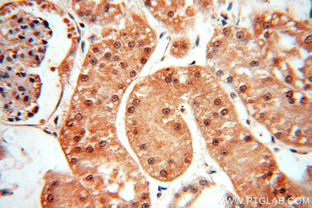 Immunohistochemistry (IHC) staining of human kidney tissue using CRM1 Polyclonal antibody (12915-1-AP)