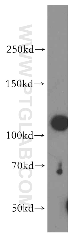 Western Blot (WB) analysis of HT-1080 cells using CRM1 Polyclonal antibody (12915-1-AP)