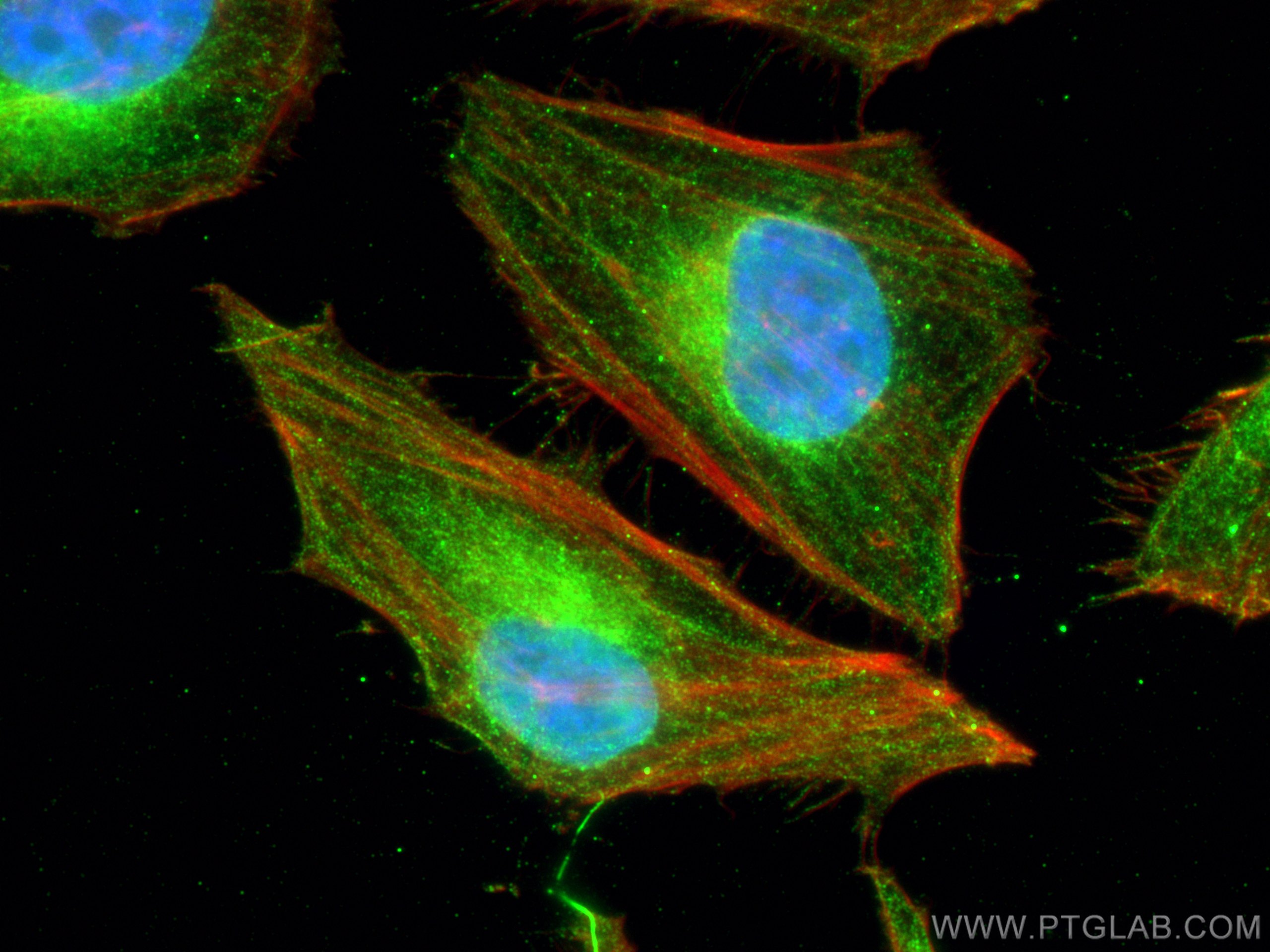 Immunofluorescence (IF) / fluorescent staining of HeLa cells using CRM1 Monoclonal antibody (66763-1-Ig)