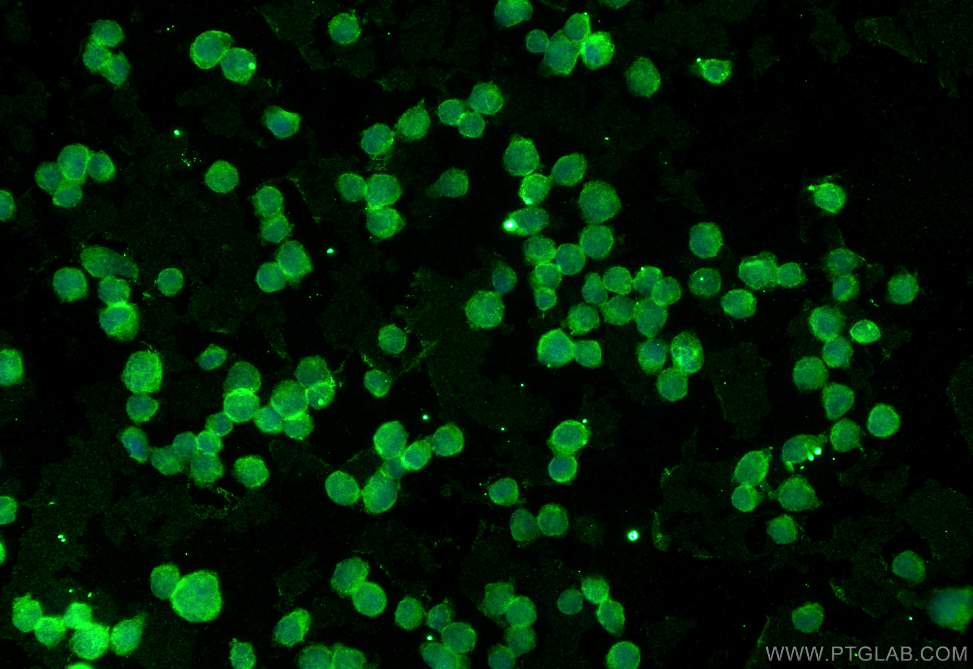 Immunofluorescence (IF) / fluorescent staining of K-562 cells using CRM1 Monoclonal antibody (66763-1-Ig)