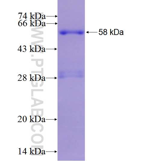 XPO1 fusion protein Ag27207 SDS-PAGE