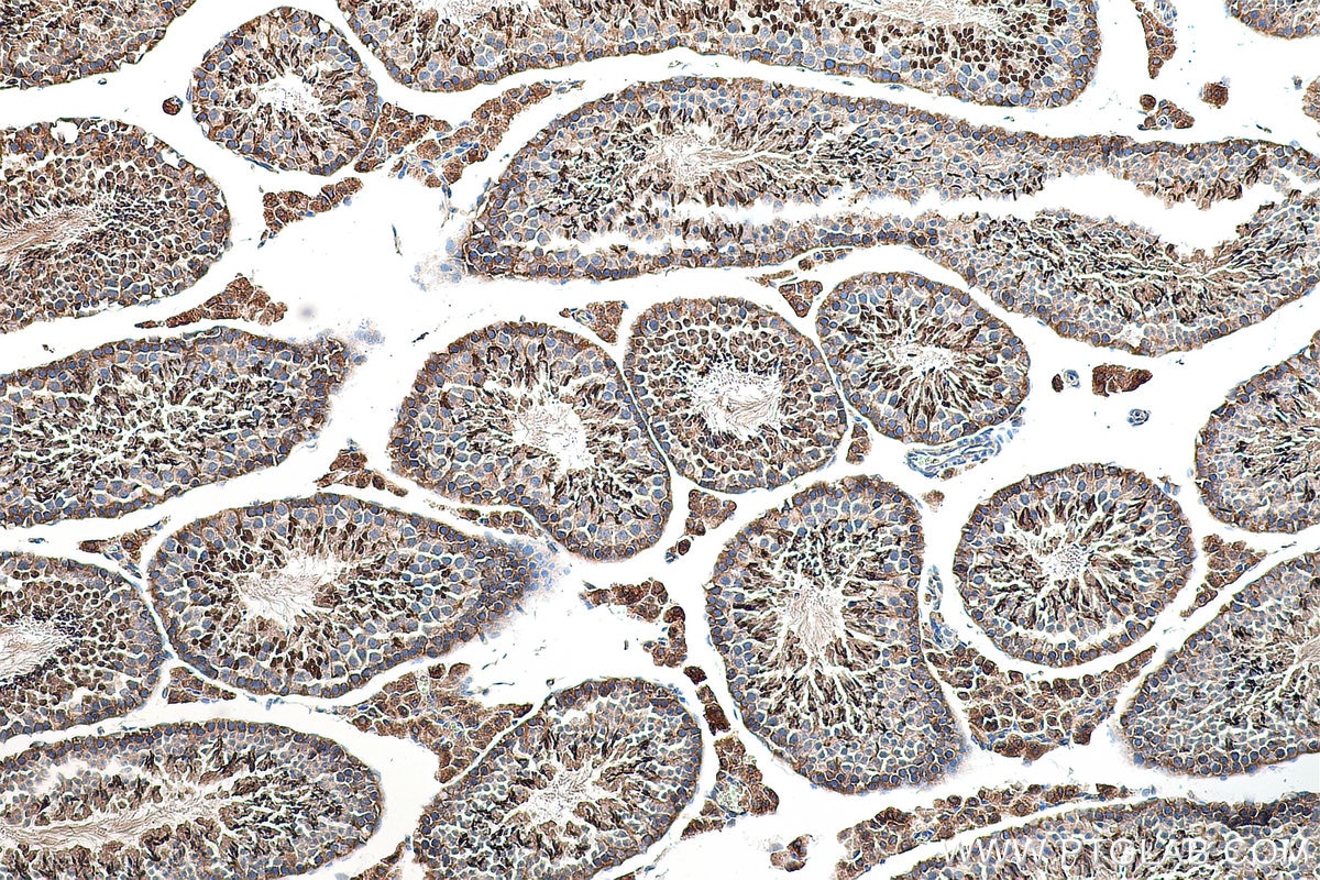 Immunohistochemistry (IHC) staining of mouse testis tissue using XPO5 Polyclonal antibody (28628-1-AP)