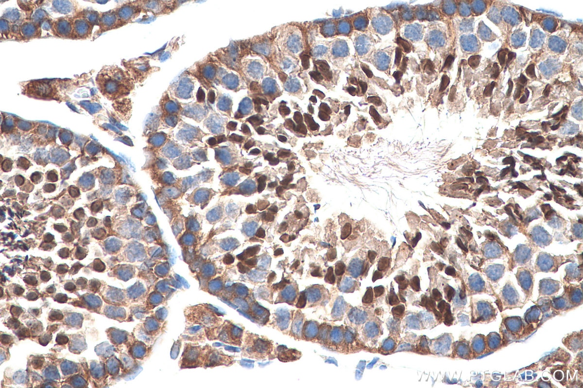 Immunohistochemistry (IHC) staining of mouse testis tissue using XPO5 Polyclonal antibody (28628-1-AP)