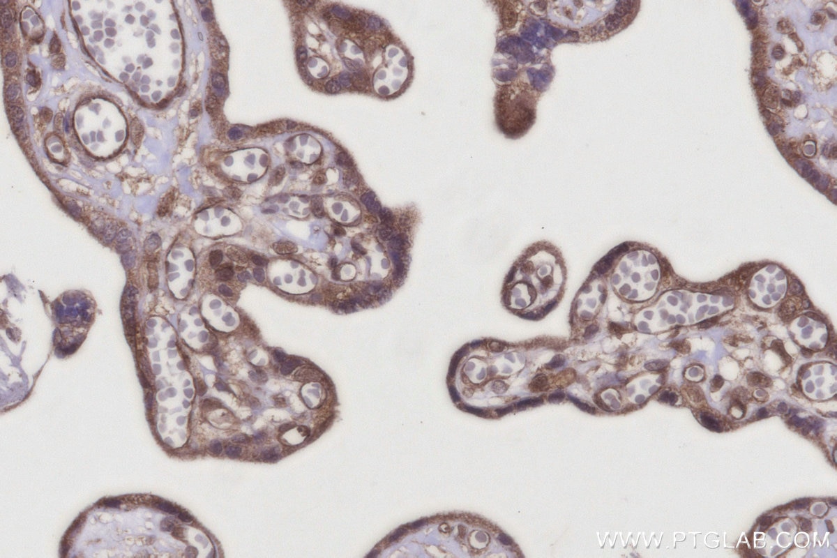 IHC staining of human placenta using 28628-1-AP Immunohistochemistry (IHC) staining of human placenta tissue using XPO5 Polyclonal antibody (28628-1-AP)
