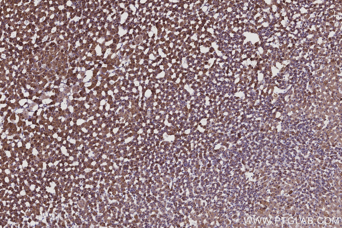 IHC staining of rat adrenal gland using 28628-1-AP Immunohistochemistry (IHC) staining of rat adrenal gland tissue using XPO5 Polyclonal antibody (28628-1-AP)