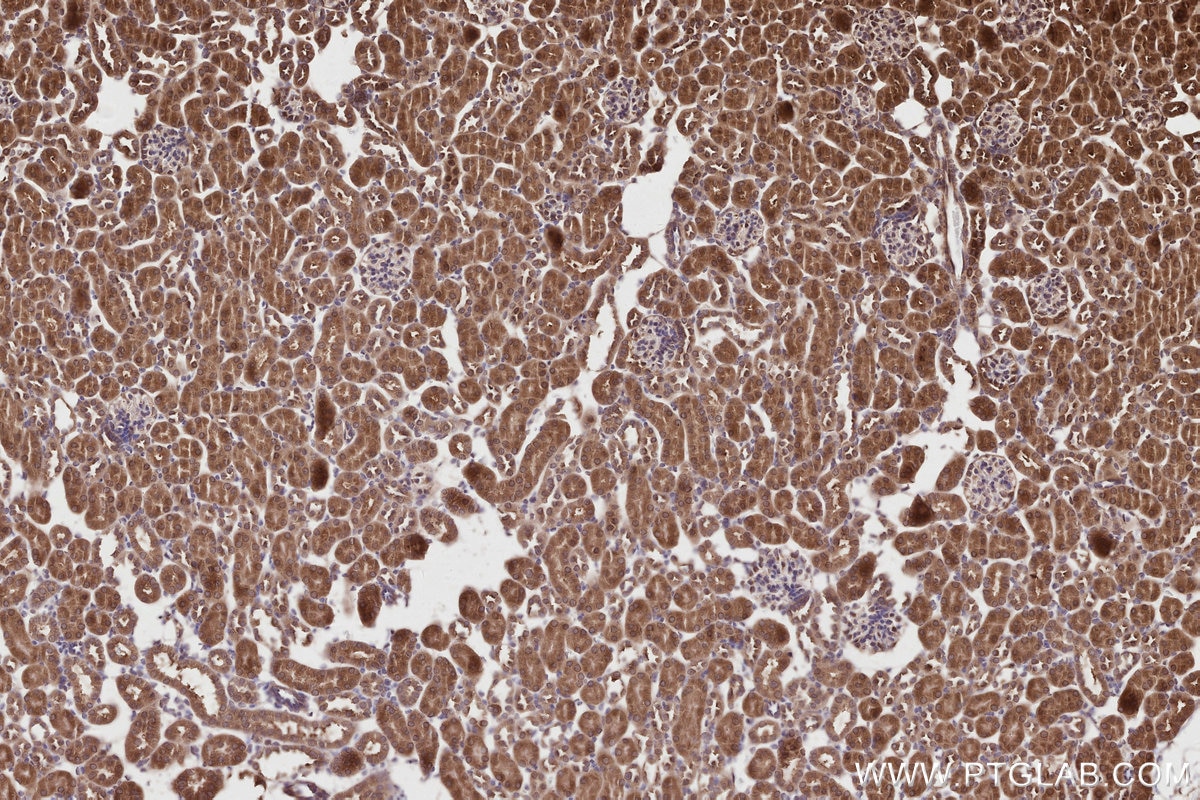 Immunohistochemistry (IHC) staining of mouse kidney tissue using XPO6 Polyclonal antibody (11408-1-AP)