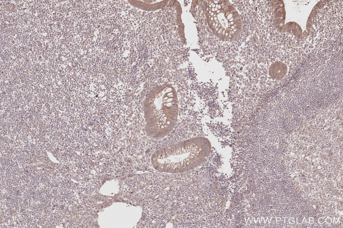 Immunohistochemistry (IHC) staining of human appendicitis tissue using XPO6 Polyclonal antibody (11408-1-AP)