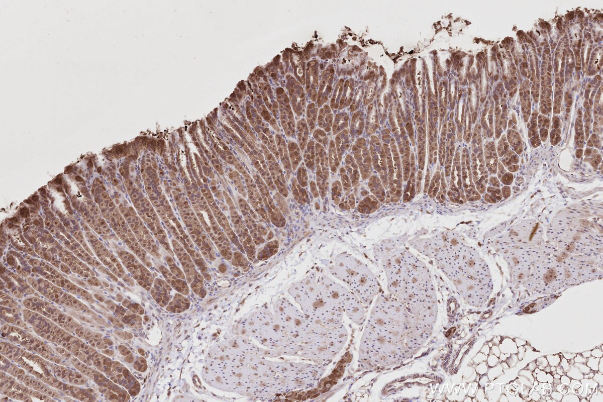 Immunohistochemistry (IHC) staining of mouse stomach tissue using XPO6 Polyclonal antibody (11408-1-AP)