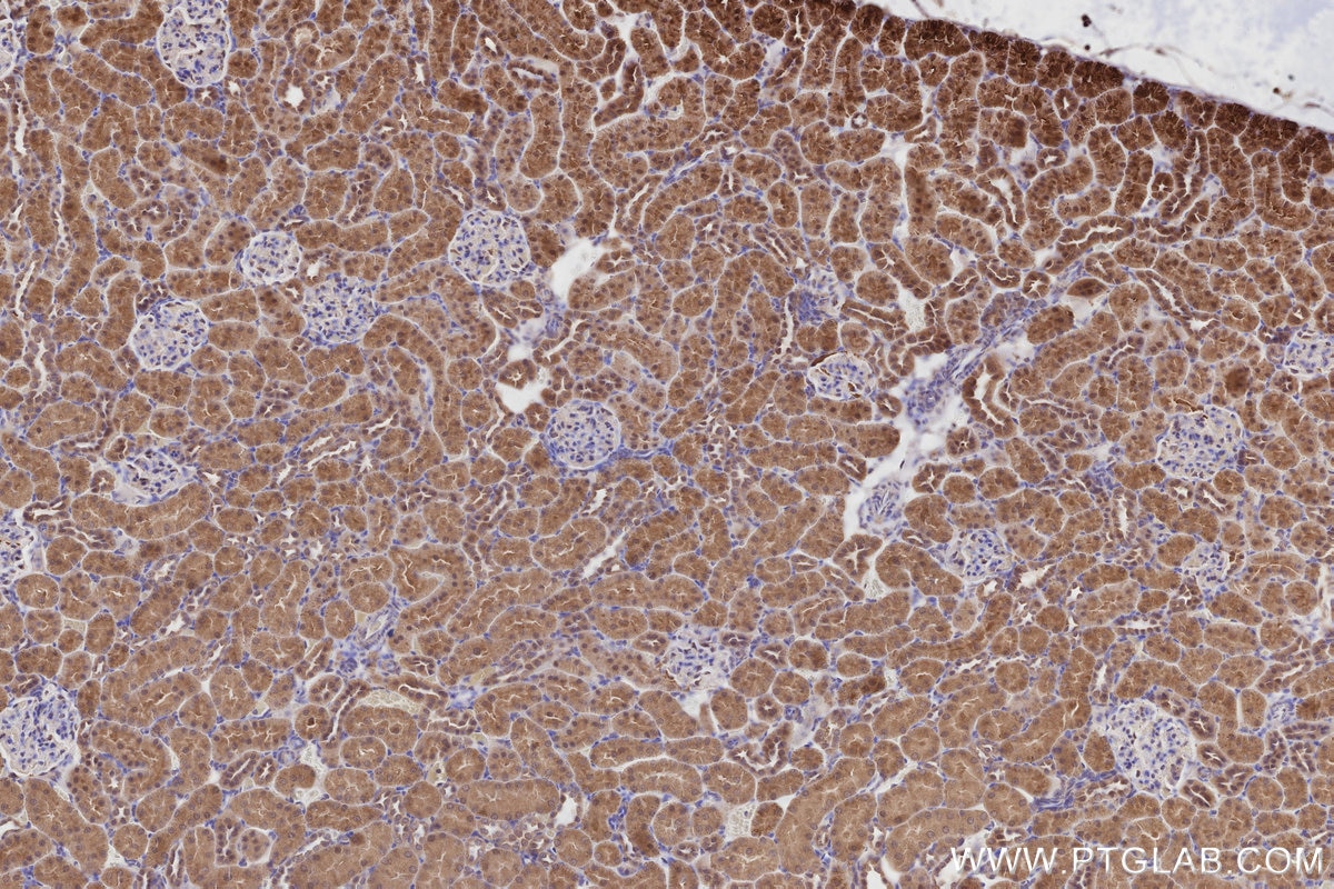 Immunohistochemistry (IHC) staining of rat kidney tissue using XPO6 Polyclonal antibody (11408-1-AP)