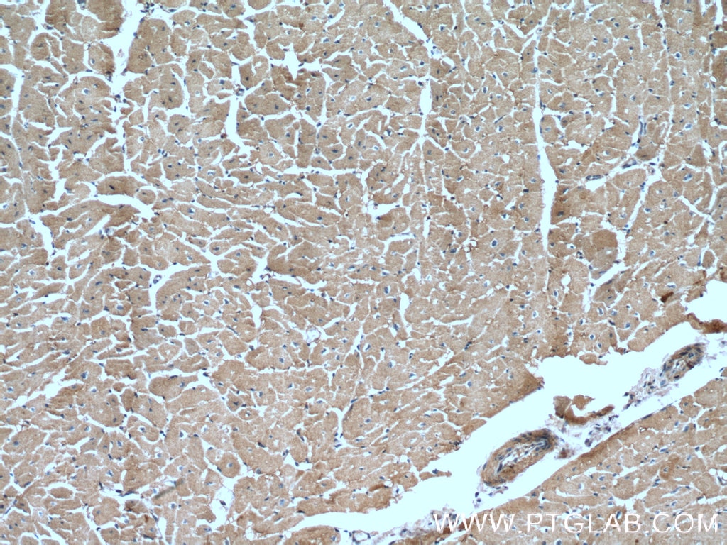IHC staining of human heart using 11408-1-AP