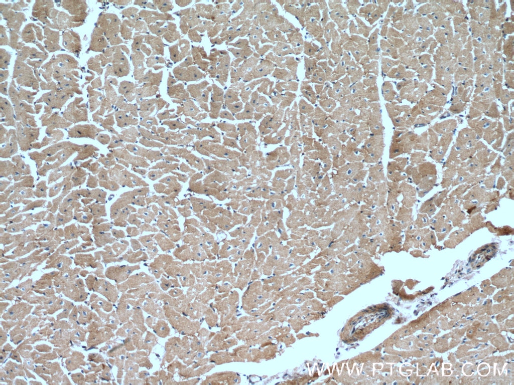 Immunohistochemistry (IHC) staining of human heart tissue using XPO6 Polyclonal antibody (11408-1-AP)