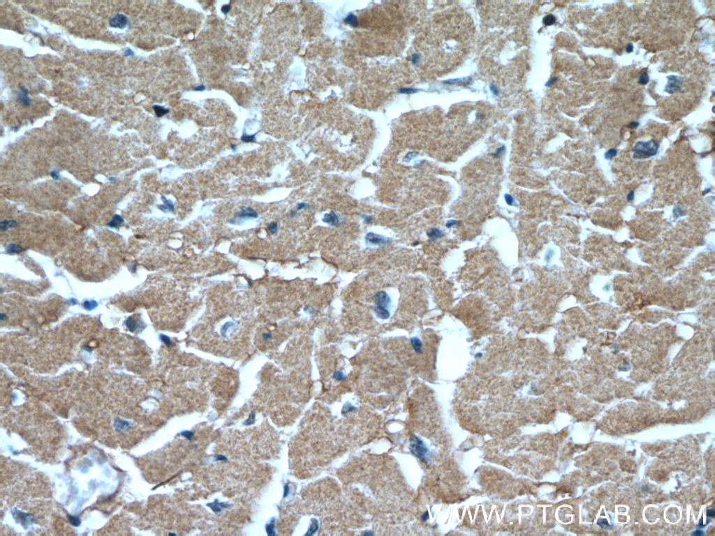 IHC staining of human heart using 11408-1-AP
