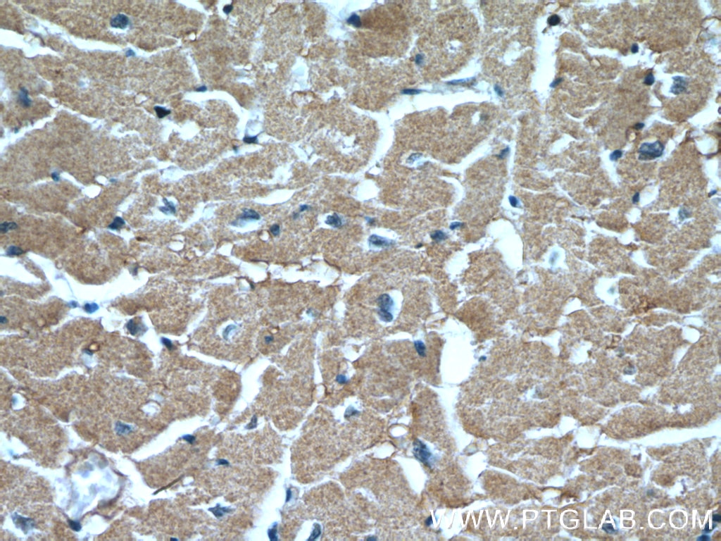 Immunohistochemistry (IHC) staining of human heart tissue using XPO6 Polyclonal antibody (11408-1-AP)