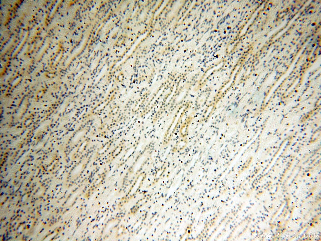 Immunohistochemistry (IHC) staining of human kidney tissue using XPO6 Polyclonal antibody (11408-1-AP)