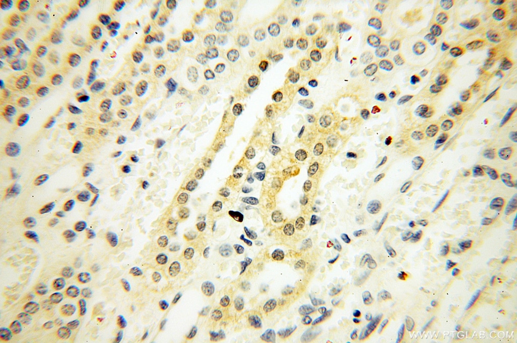 Immunohistochemistry (IHC) staining of human kidney tissue using XPO6 Polyclonal antibody (11408-1-AP)
