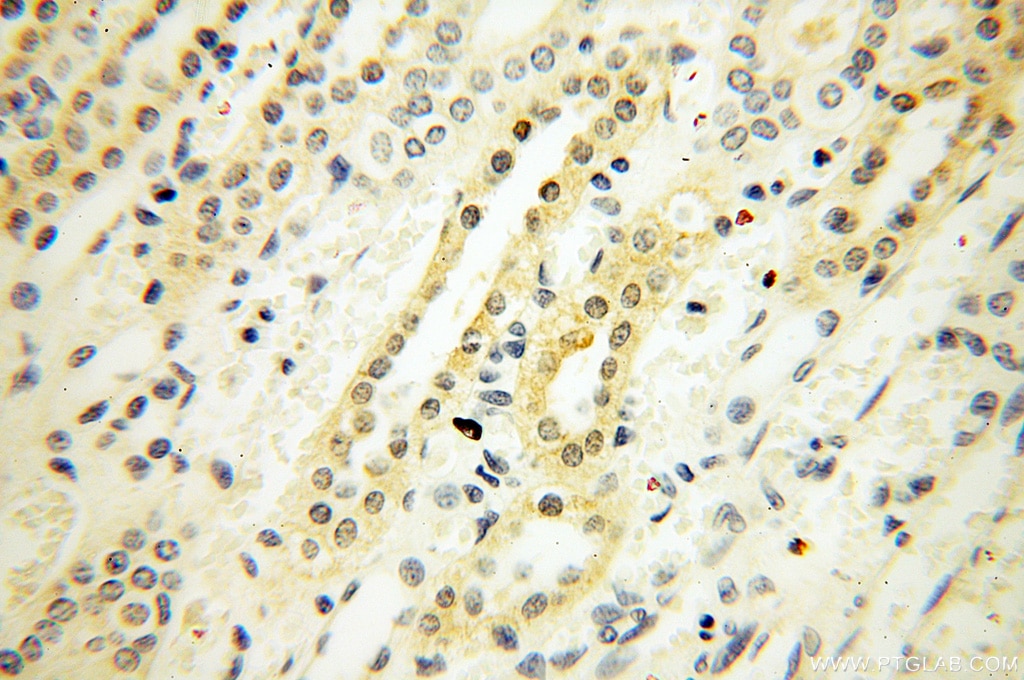 IHC staining of human kidney using 11408-1-AP