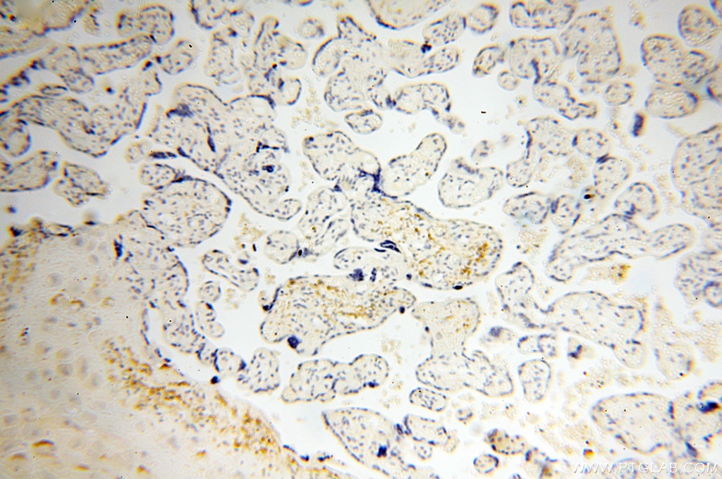 Immunohistochemistry (IHC) staining of human placenta tissue using XPO6 Polyclonal antibody (11408-1-AP)