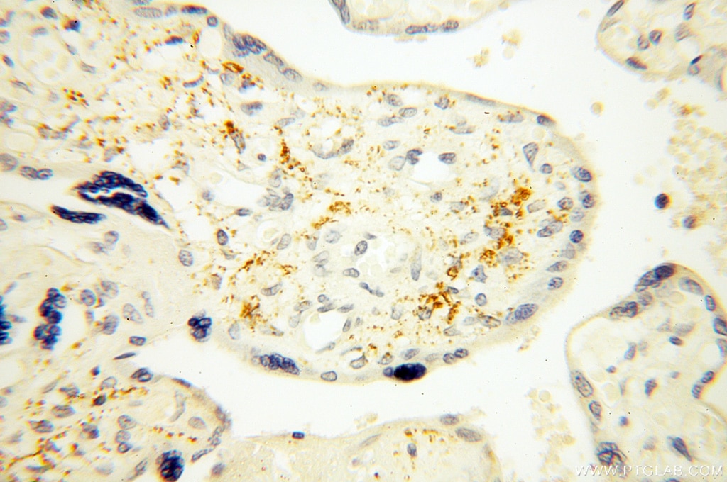 Immunohistochemistry (IHC) staining of human placenta tissue using XPO6 Polyclonal antibody (11408-1-AP)