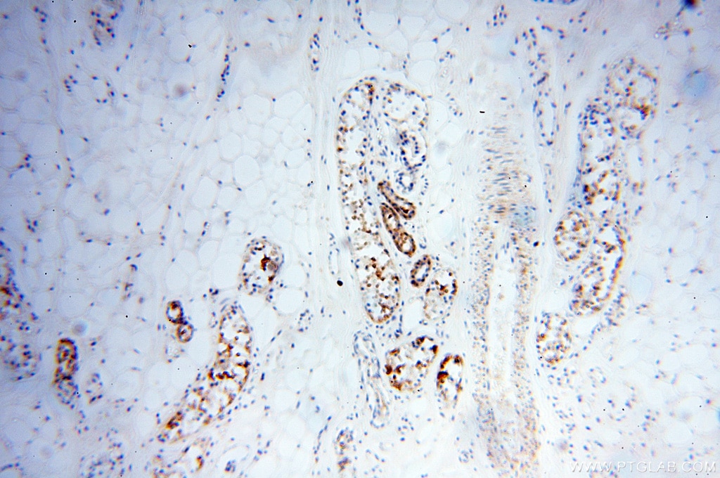 Immunohistochemistry (IHC) staining of human skin tissue using XPO6 Polyclonal antibody (11408-1-AP)