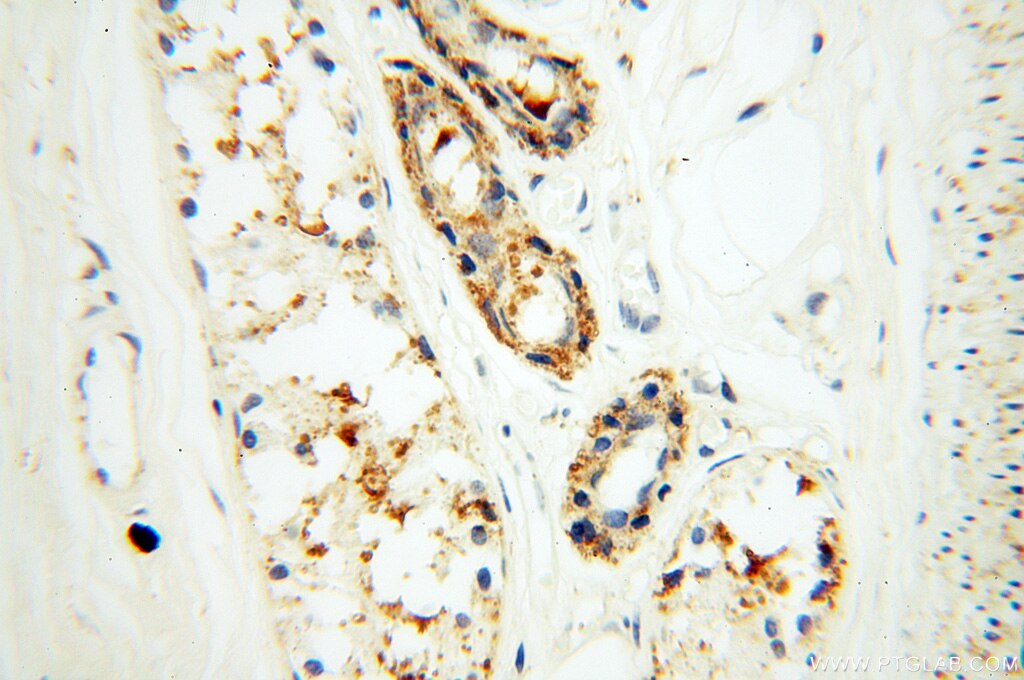 Immunohistochemistry (IHC) staining of human skin tissue using XPO6 Polyclonal antibody (11408-1-AP)