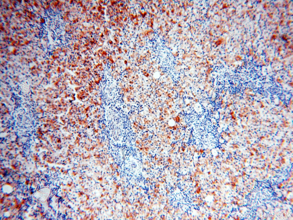 Immunohistochemistry (IHC) staining of human ovary tissue using XPO6 Polyclonal antibody (11408-1-AP)