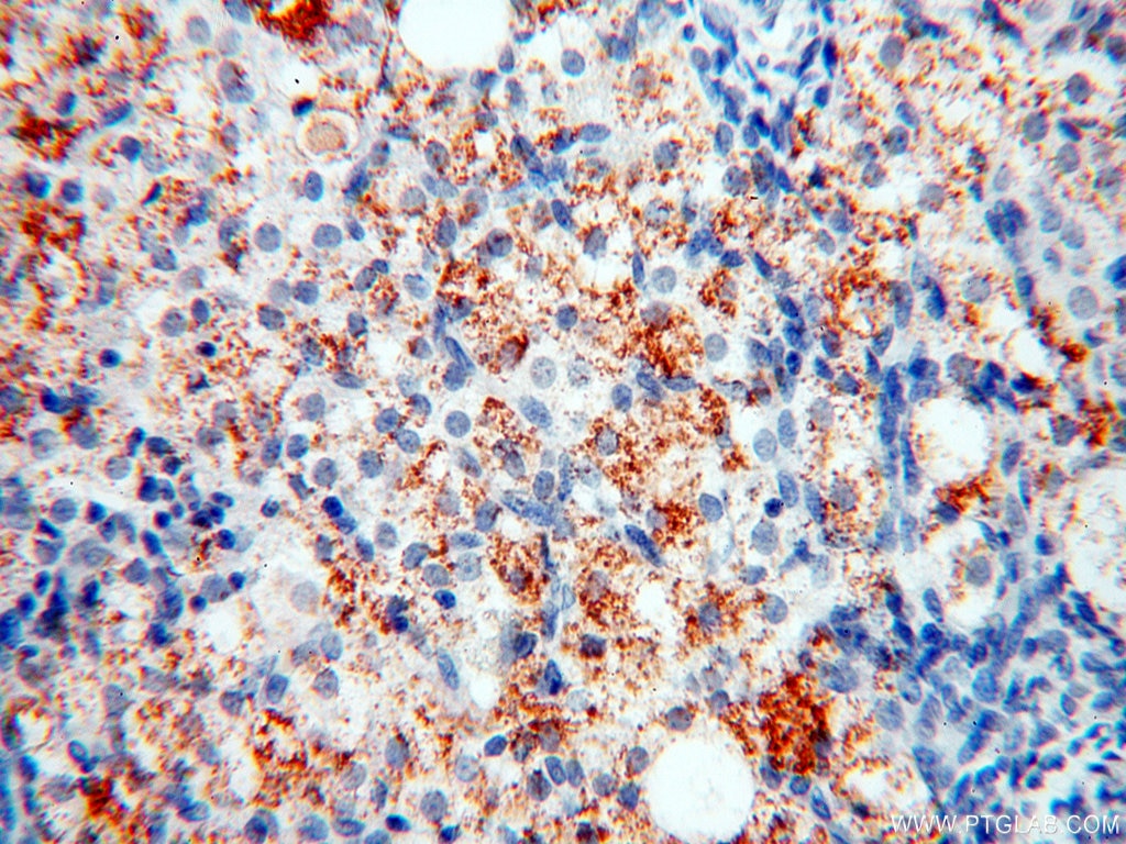 Immunohistochemistry (IHC) staining of human ovary tissue using XPO6 Polyclonal antibody (11408-1-AP)