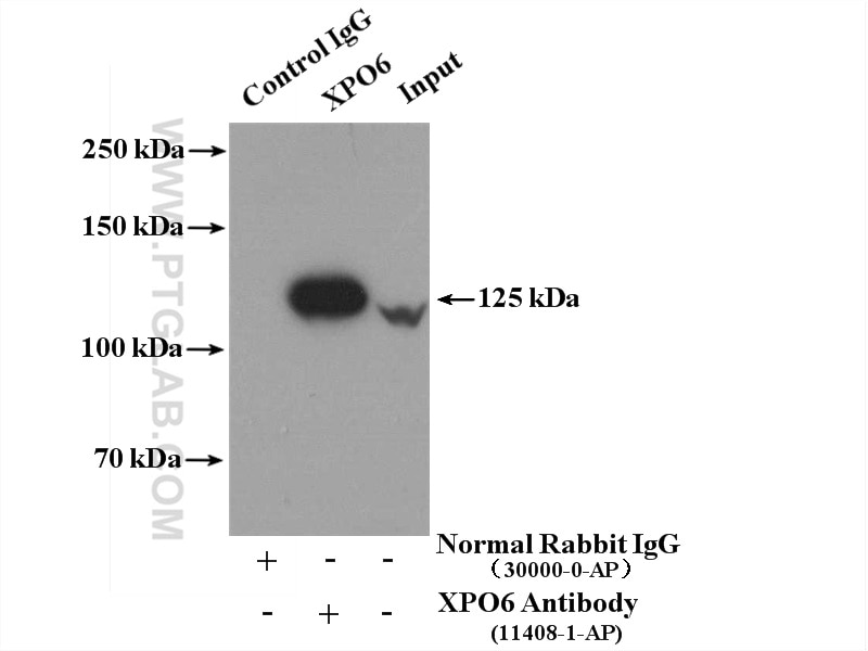 Immunoprecipitation (IP) experiment of HeLa cells using XPO6 Polyclonal antibody (11408-1-AP)