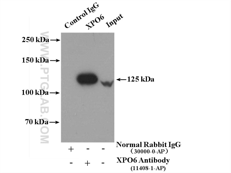 IP experiment of HeLa using 11408-1-AP