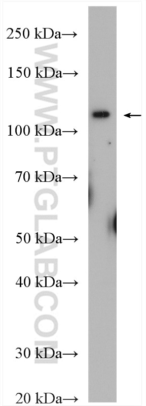 Western Blot (WB) analysis of HeLa cells using XPO6 Polyclonal antibody (11408-1-AP)