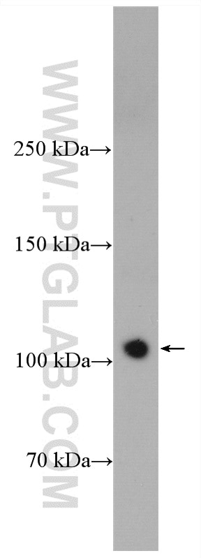 Western Blot (WB) analysis of mouse spleen tissue using XPO7 Polyclonal antibody (12980-1-AP)
