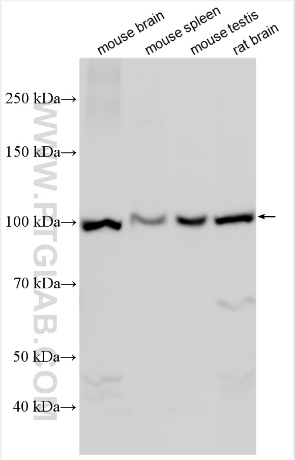 Western Blot (WB) analysis of various lysates using XPO7 Polyclonal antibody (12980-1-AP)