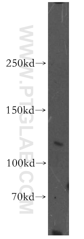 Western Blot (WB) analysis of human brain tissue using XPO7 Polyclonal antibody (12980-1-AP)