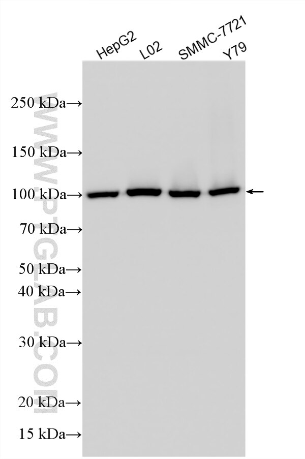 Western Blot (WB) analysis of various lysates using XPOT Polyclonal antibody (12577-1-AP)