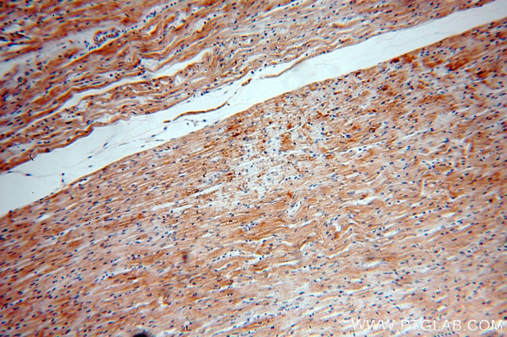 Immunohistochemistry (IHC) staining of human heart tissue using XPR1 Polyclonal antibody (14174-1-AP)