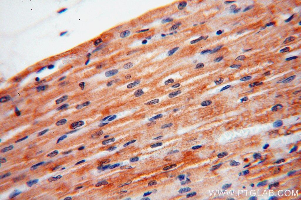 Immunohistochemistry (IHC) staining of human heart tissue using XPR1 Polyclonal antibody (14174-1-AP)