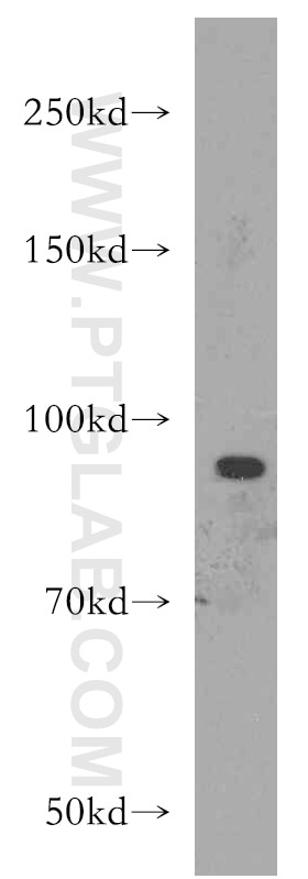 Western Blot (WB) analysis of Jurkat cells using XPR1 Polyclonal antibody (14174-1-AP)