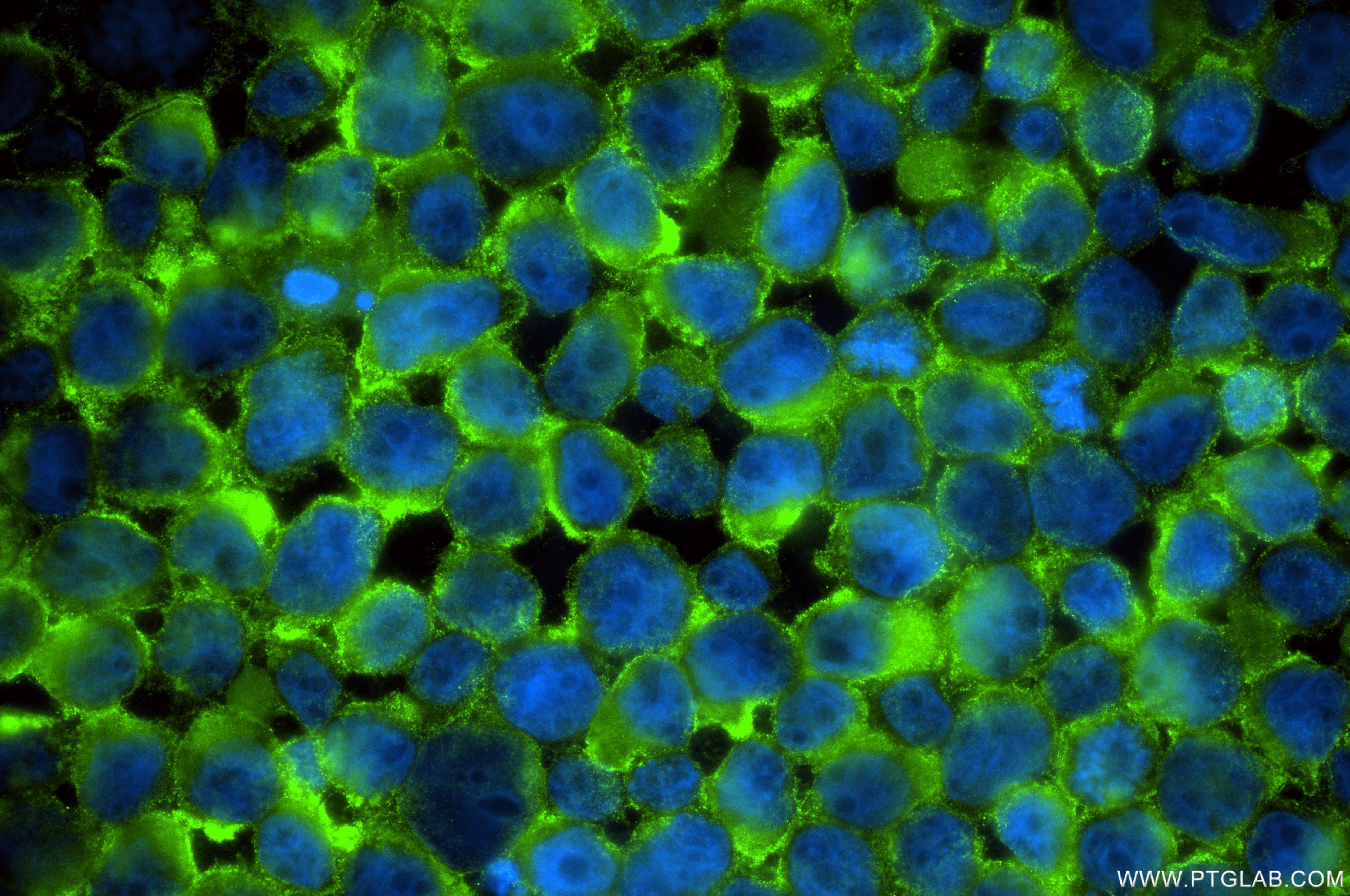 Immunofluorescence (IF) / fluorescent staining of HL-60 cells using XPR1 Recombinant monoclonal antibody (84902-1-RR)
