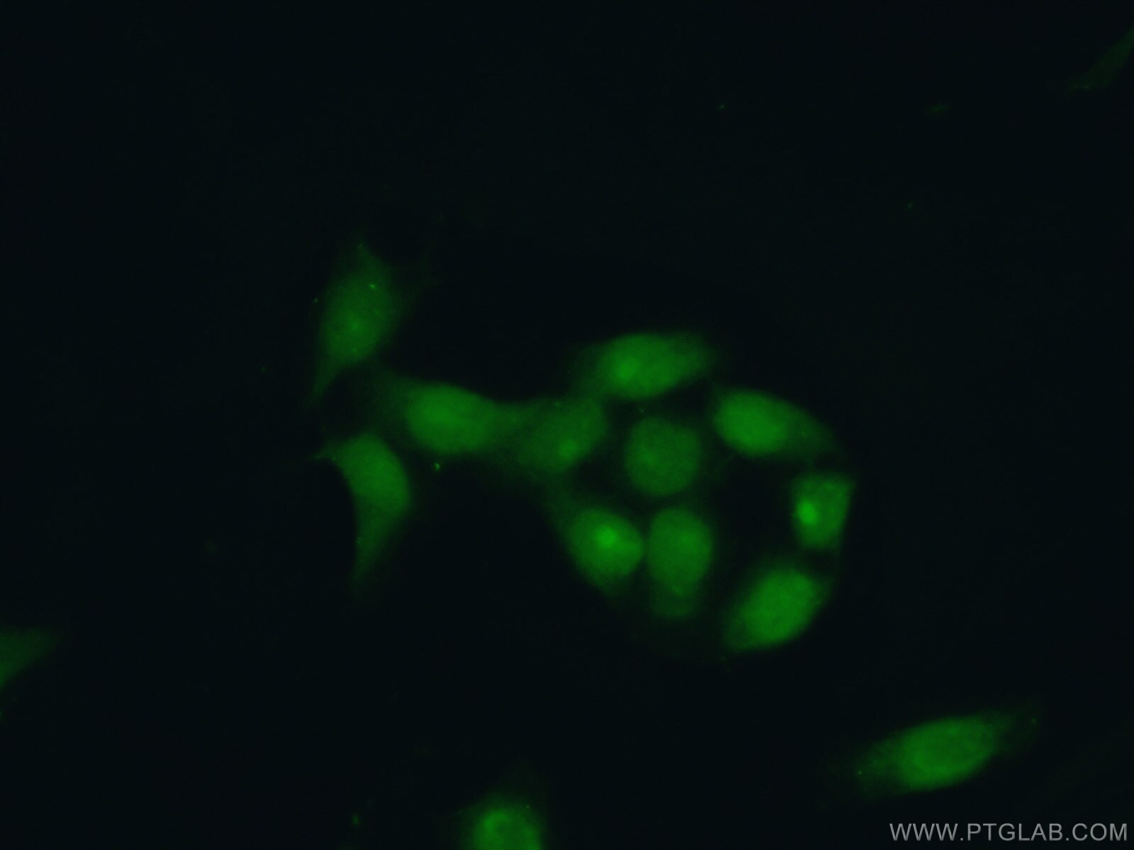 Immunofluorescence (IF) / fluorescent staining of HeLa cells using XRCC1 Polyclonal antibody (21468-1-AP)